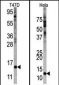 FAU Antibody (Center)